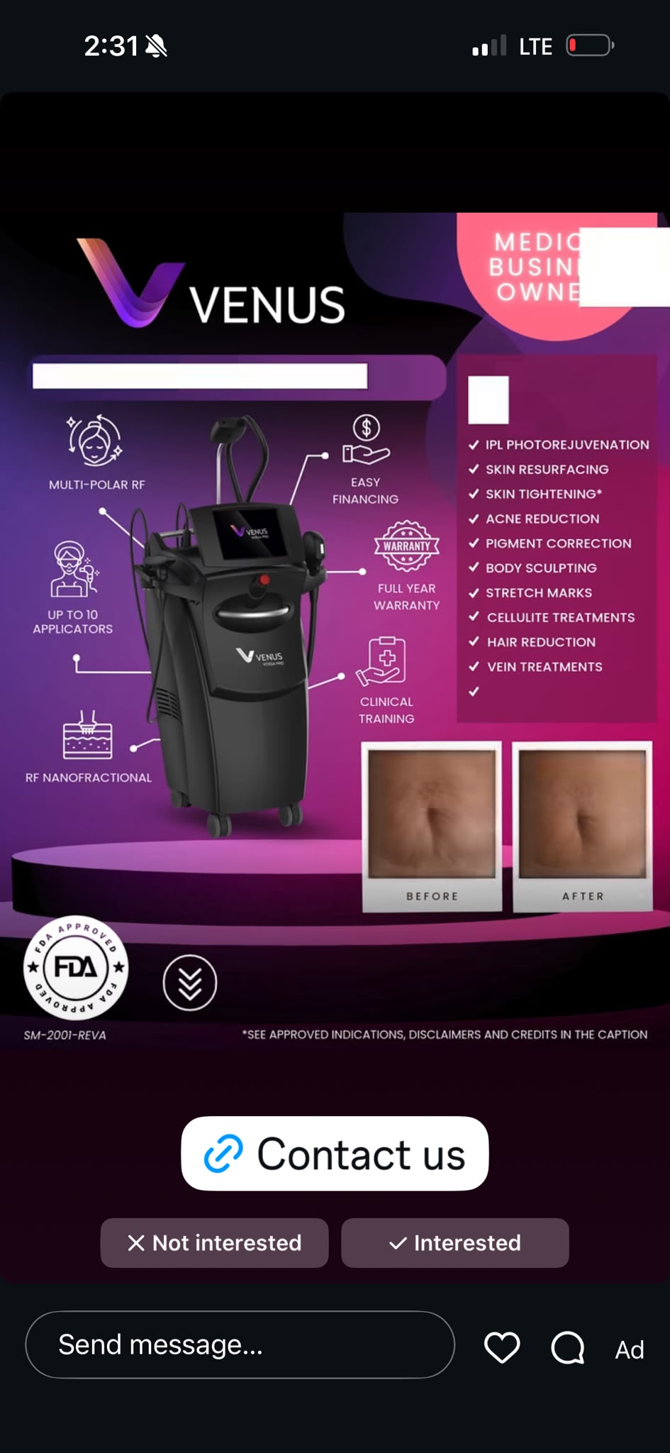 Fat Reduction