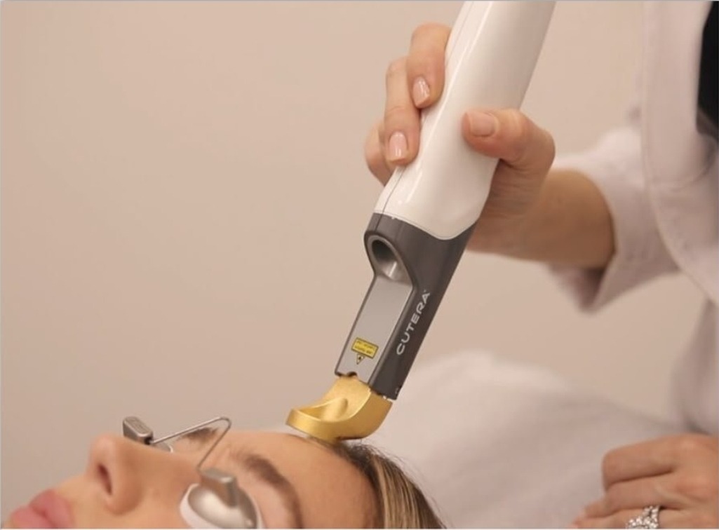 Skin Tightening