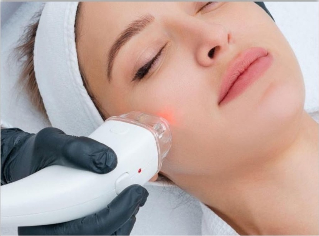 Laser Hair Removal