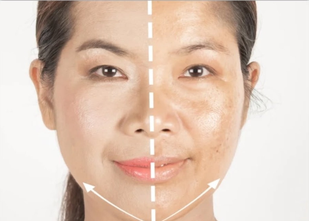 Pigmentation