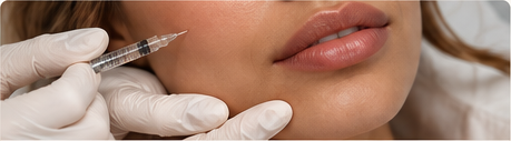 Dermal Fillers